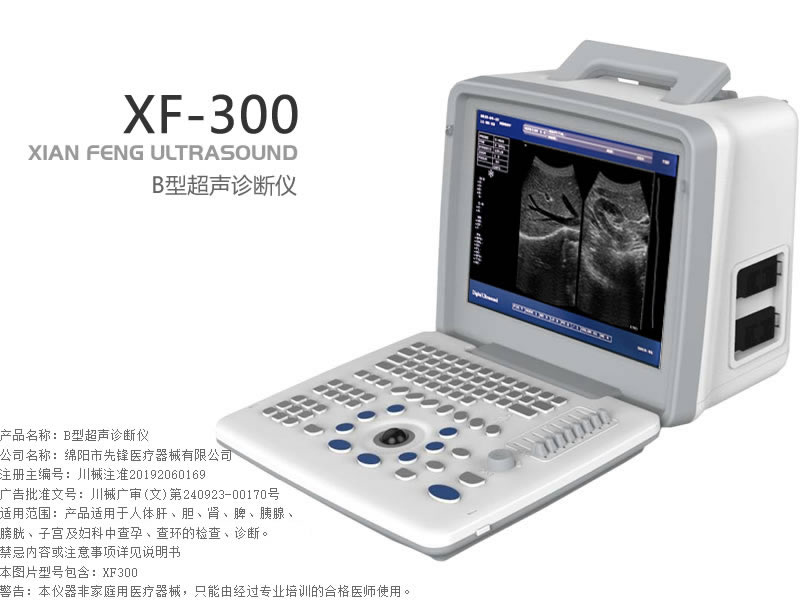 B型超声诊断仪